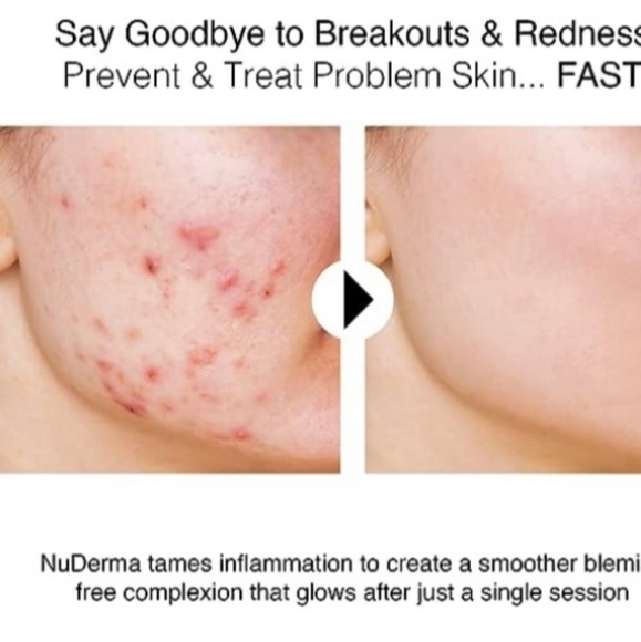 Nu Derma - Picture 8 of 9